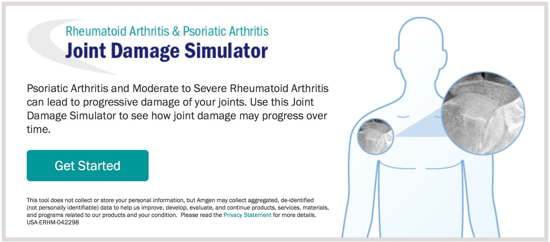 Joint Damage Simulator.jpeg