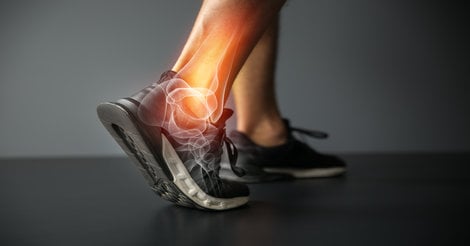 image of a foot with sprained ankle